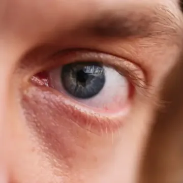 The Everyday Essentials People Forget When Caring for Their Eyes